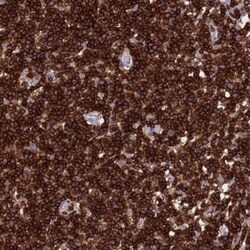 PTPRCAP Antibody, Novus Biologicals 0.1mL; Unlabeled:Antibodies, Polyclonal