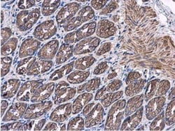 PTPRH Antibody, Novus Biologicals 0.1 mL | Buy Online | Novus Biologicals | Fisher Scientific