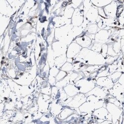 PTRH1 Antibody, Novus Biologicals 0.1mL; Unlabeled:Antibodies, Polyclonal