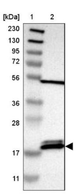 PTRH2 Antibody, Novus Biologicals 25 &mu;L | Buy Online | Novus Biologicals | Fisher Scientific