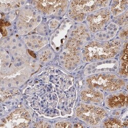 PTS Antibody, Novus Biologicals:Antibodies:Primary Antibodies