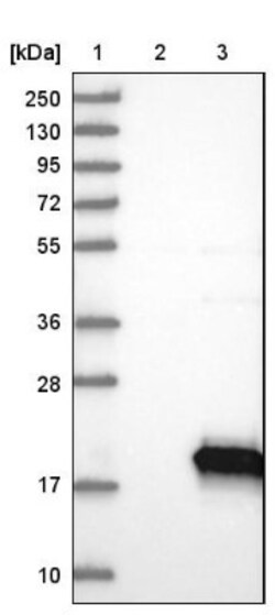 PTS Antibody, Novus Biologicals:Antibodies:Primary Antibodies
