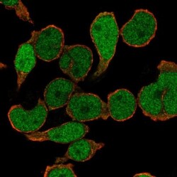 PU.1/Spi-1 Antibody, Novus Biologicals 0.1mL; Unlabeled:Antibodies, Polyclonal