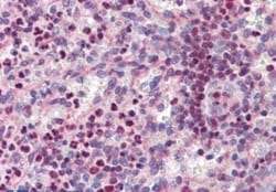 PU.1/Spi-1 Antibody, Novus Biologicals 0.1mg; Unlabeled:Antibodies, Polyclonal