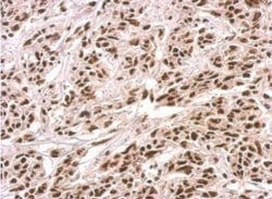 PUF60 Antibody, Novus Biologicals 0.1mL; Unlabeled:Antibodies, Polyclonal