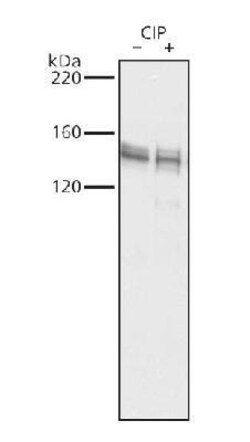 PUM1 Antibody, Novus Biologicals 100 &mu;L | Buy Online | Novus Biologicals | Fisher Scientific