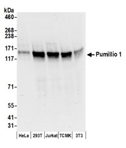 PUM1 Antibody, Novus Biologicals 100 &mu;L | Buy Online | Novus Biologicals | Fisher Scientific