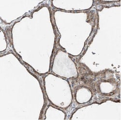 PUM2 Antibody, Novus Biologicals:Antibodies:Primary Antibodies
