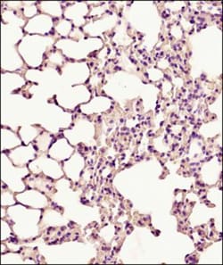 PUMA Antibody, Novus Biologicals 0.025mg; Unlabeled:Antibodies, Polyclonal