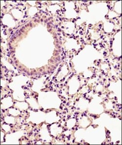 PUMA Antibody, Novus Biologicals 0.025mg; Unlabeled:Antibodies, Polyclonal
