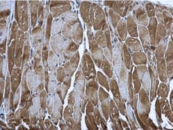 PUS1 Antibody, Novus Biologicals 0.1mg; Unlabeled:Antibodies, Polyclonal