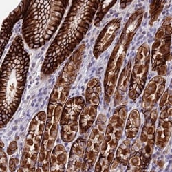 PUS10 Antibody, Novus Biologicals 25 &mu;L, Unlabeled:Antibodies, Polyclonal