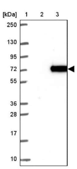 PUS10 Antibody, Novus Biologicals 25 &mu;L, Unlabeled:Antibodies, Polyclonal