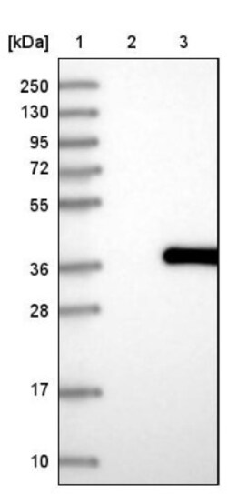 PUSL1 Antibody, Novus Biologicals 0.1mL; Unlabeled:Antibodies, Polyclonal