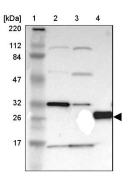 PX19 Antibody, Novus Biologicals:Antibodies:Primary Antibodies