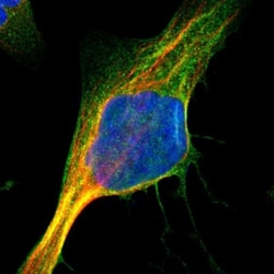 PYGL Antibody, Novus Biologicals:Antibodies:Primary Antibodies