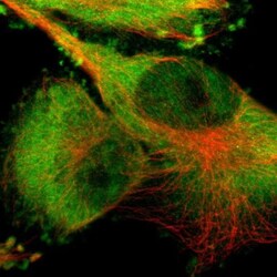 PYGL Antibody, Novus Biologicals 0.1mL; Unlabeled:Antibodies, Polyclonal
