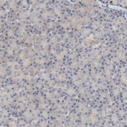 PYGL Antibody, Novus Biologicals:Antibodies:Primary Antibodies