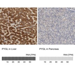 PYGL Antibody, Novus Biologicals:Antibodies:Primary Antibodies