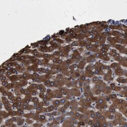 PYGL Antibody, Novus Biologicals 0.1mL; Unlabeled:Antibodies, Polyclonal