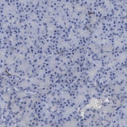 PYGL Antibody, Novus Biologicals 0.1mL; Unlabeled:Antibodies, Polyclonal