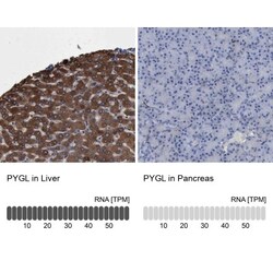 PYGL Antibody, Novus Biologicals 0.1mL; Unlabeled:Antibodies, Polyclonal