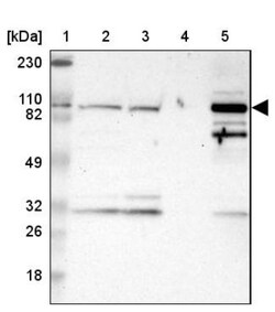 PYGL Antibody, Novus Biologicals:Antibodies:Primary Antibodies