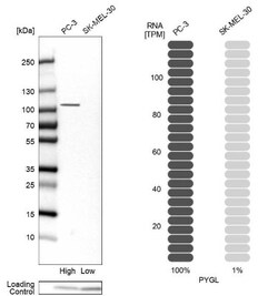PYGL Antibody, Novus Biologicals:Antibodies:Primary Antibodies