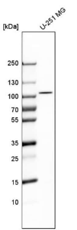 PYGL Antibody, Novus Biologicals 0.1mL; Unlabeled:Antibodies, Polyclonal
