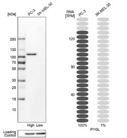 PYGL Antibody, Novus Biologicals 0.1mL; Unlabeled:Antibodies, Polyclonal