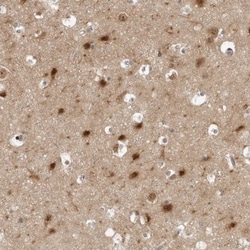 PYK2/FAK2 Antibody, Novus Biologicals 0.1mL; Unlabeled:Antibodies, Polyclonal