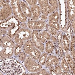 PYROXD1 Antibody, Novus Biologicals 25 &mu;L, Unlabeled:Antibodies, Polyclonal