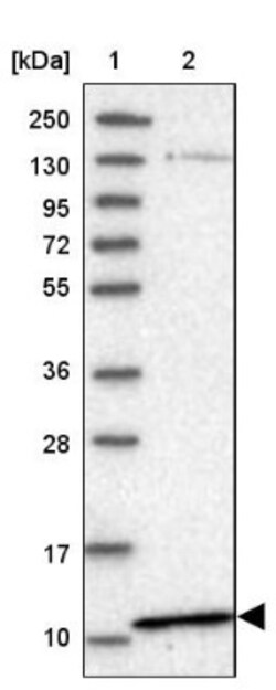 PYURF Antibody, Novus Biologicals 0.1mL; Unlabeled:Antibodies, Polyclonal