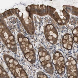 Paladin Antibody, Novus Biologicals:Antibodies:Primary Antibodies