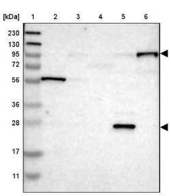 Paladin Antibody, Novus Biologicals:Antibodies:Primary Antibodies