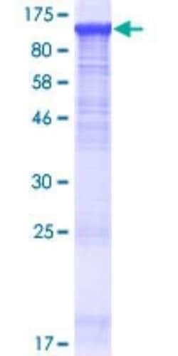 Novus Biologicals Recombinant Human Paladin GST (N-Term) Protein 10 &mu;g | Buy Online | Novus Biologicals&trade; | Fisher Scientific