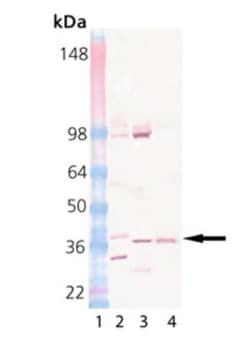 Pallidin Antibody (15G2), Novus Biologicals 0.05 mg | Buy Online | Novus Biologicals | Fisher Scientific
