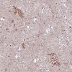 Pan KvBeta Antibody, Novus Biologicals:Antibodies:Primary Antibodies