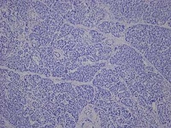 Novus Biologicals&trade;&nbsp;Pancreas Tissue Slides (Diabetes)- Paraffin