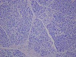 Novus Biologicals Pancreas Tissue Slides (Liver Cirrhosis)- Paraffin 5 Slides | Buy Online | Novus Biologicals&trade; | Fisher Scientific