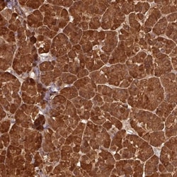 Pancreatic Lipase Antibody, Novus Biologicals 0.1mL; Unlabeled:Antibodies,