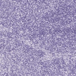 Pancreatic Lipase Antibody, Novus Biologicals 0.1mL; Unlabeled:Antibodies,