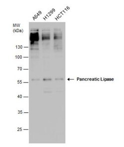 Pancreatic Lipase Antibody, Novus Biologicals 100 &mu;L | Buy Online | Novus Biologicals | Fisher Scientific