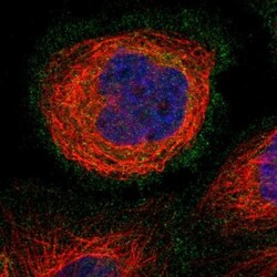 Pannexin-1 Antibody, Novus Biologicals 25 &mu;L | Buy Online | Novus Biologicals | Fisher Scientific