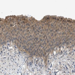 25UL Rabbit Polyclonal Pannexin-1 Ab