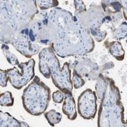 Pappalysin-1/PAPP-A Antibody (PAPP A 1-1) - BSA Free, Novus Biologicals