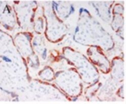 Pappalysin-1/PAPP-A Antibody (PAPP A 1-1) - BSA Free, Novus Biologicals