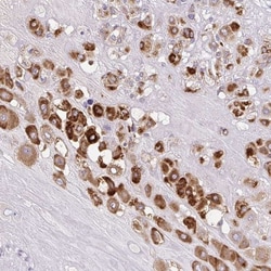 Pappalysin-2/PAPP-A2 Antibody, Novus Biologicals:Antibodies:Primary Antibodies