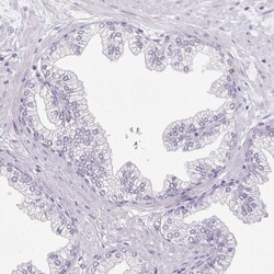 Pappalysin-2/PAPP-A2 Antibody, Novus Biologicals:Antibodies:Primary Antibodies