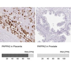 Pappalysin-2/PAPP-A2 Antibody, Novus Biologicals:Antibodies:Primary Antibodies